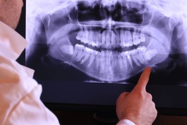 Best Broken or Cracked Tooth Emergency Dentist in Post Falls, ID